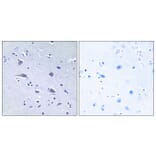 Immunohistochemistry - Anti-p70 S6 Kinase (phospho Thr229) Antibody (A0531) - Antibodies.com