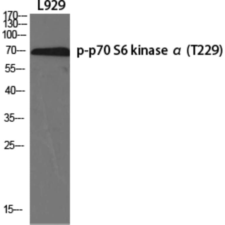 Western Blot - Anti-p70 S6 Kinase (phospho Thr229) Antibody (A0531) - Antibodies.com