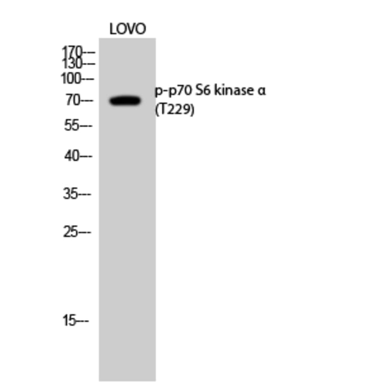 Western Blot - Anti-p70 S6 Kinase (phospho Thr229) Antibody (A0531) - Antibodies.com