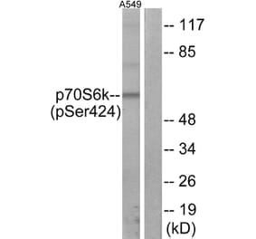 Western Blot - Anti-p70 S6 Kinase (phospho Ser424) Antibody (A7189) - Antibodies.com