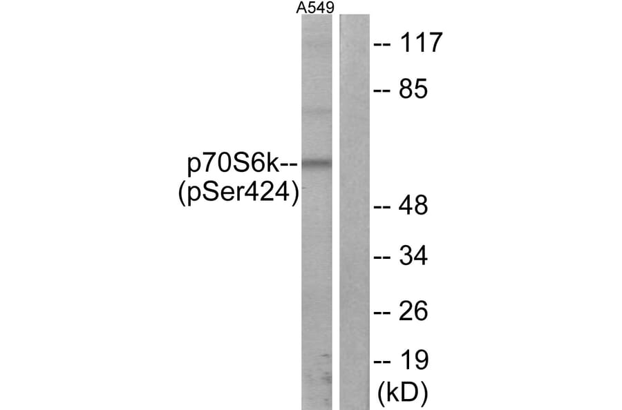 Western Blot - Anti-p70 S6 Kinase (phospho Ser424) Antibody (A7189) - Antibodies.com