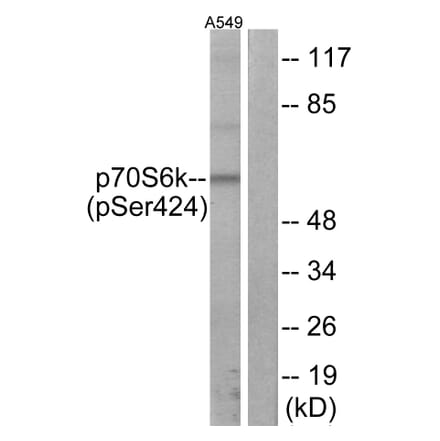 Western Blot - Anti-p70 S6 Kinase (phospho Ser424) Antibody (A7189) - Antibodies.com