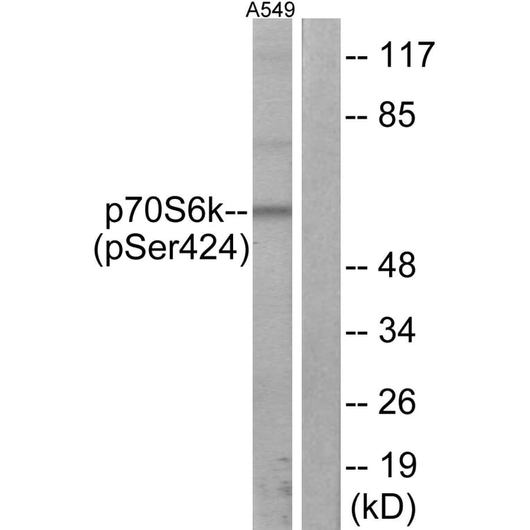 Western Blot - Anti-p70 S6 Kinase (phospho Ser424) Antibody (A7189) - Antibodies.com
