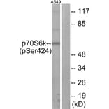 Western Blot - Anti-p70 S6 Kinase (phospho Ser424) Antibody (A7189) - Antibodies.com