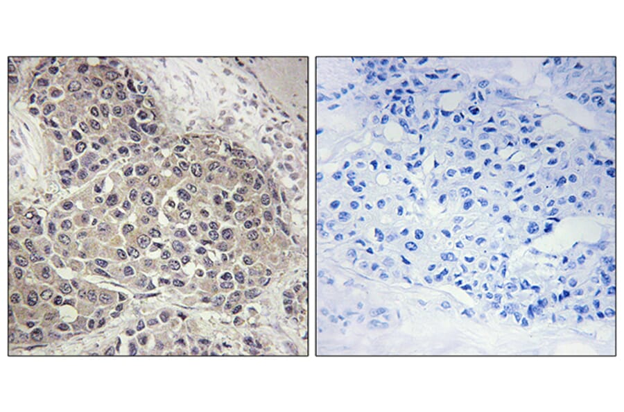 Immunohistochemistry - Anti-p70 S6 Kinase (phospho Ser424) Antibody (A7189) - Antibodies.com