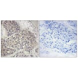 Immunohistochemistry - Anti-p70 S6 Kinase (phospho Ser424) Antibody (A7189) - Antibodies.com