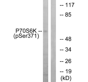 Western Blot - Anti-p70 S6 Kinase (phospho Ser371) Antibody (A0532) - Antibodies.com