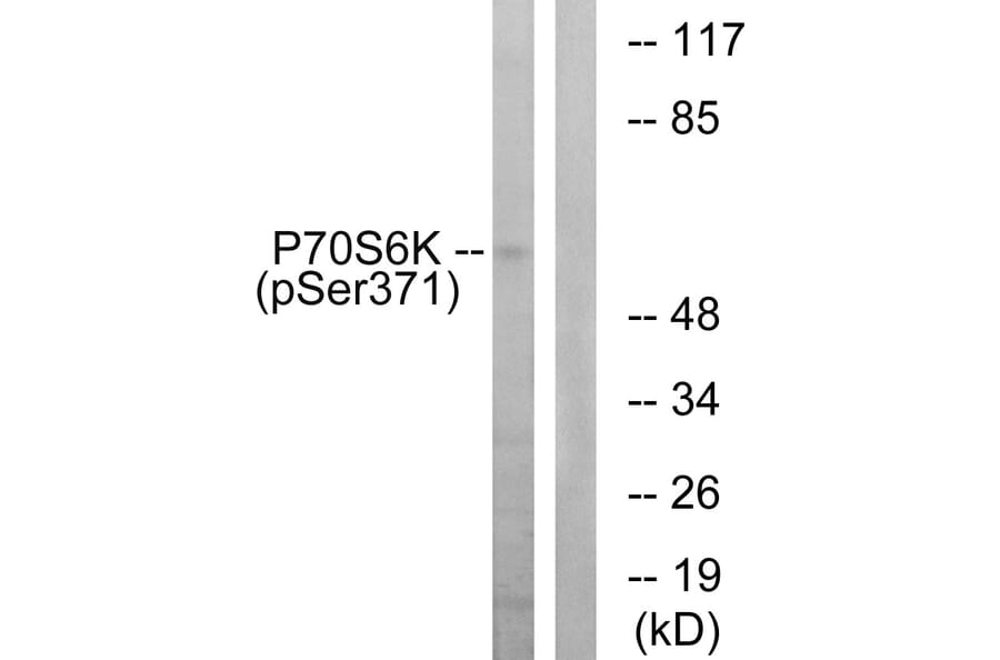 Western Blot - Anti-p70 S6 Kinase (phospho Ser371) Antibody (A0532) - Antibodies.com