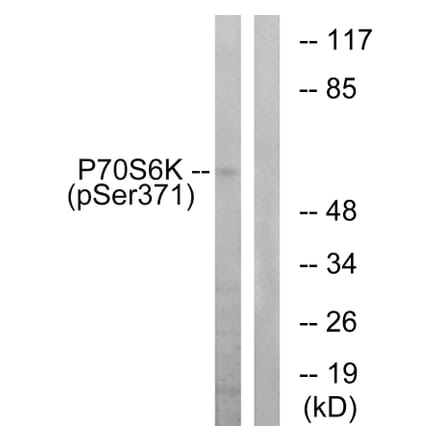 Western Blot - Anti-p70 S6 Kinase (phospho Ser371) Antibody (A0532) - Antibodies.com