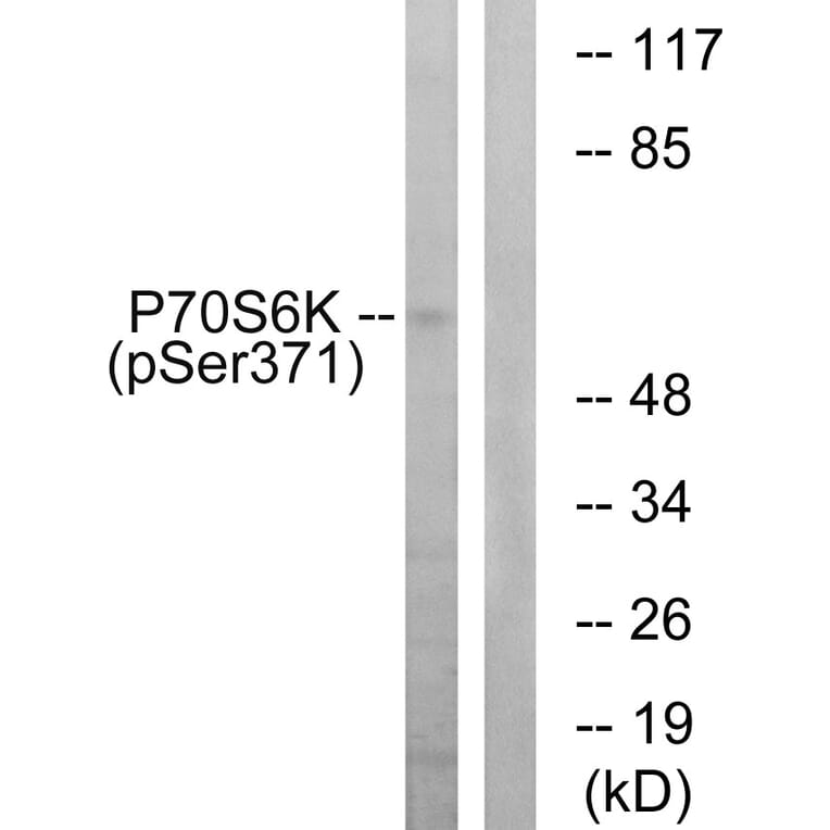 Western Blot - Anti-p70 S6 Kinase (phospho Ser371) Antibody (A0532) - Antibodies.com