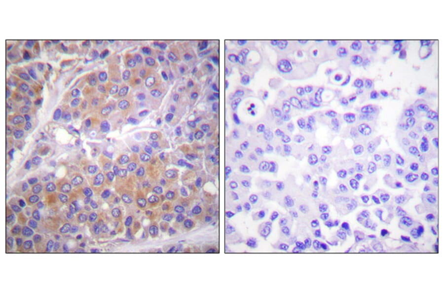 Immunohistochemistry - Anti-p70 S6 Kinase (phospho Ser371) Antibody (A0532) - Antibodies.com