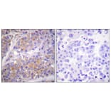 Immunohistochemistry - Anti-p70 S6 Kinase (phospho Ser371) Antibody (A0532) - Antibodies.com