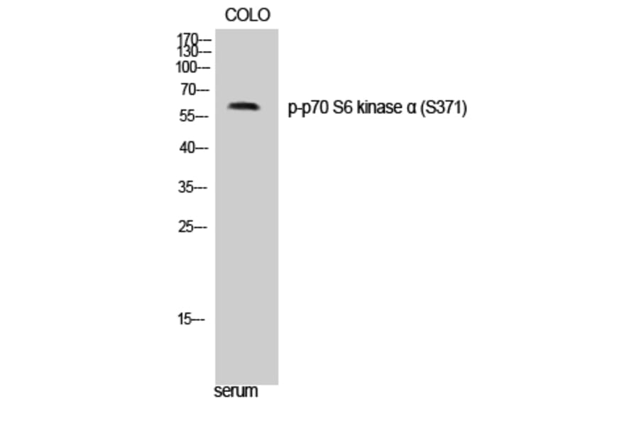 Western Blot - Anti-p70 S6 Kinase (phospho Ser371) Antibody (A0532) - Antibodies.com