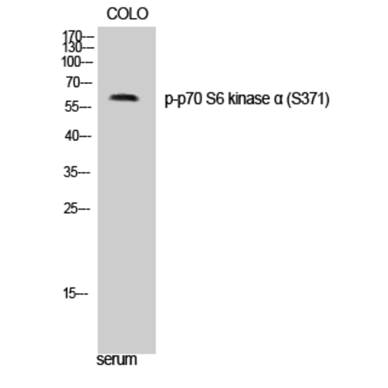 Western Blot - Anti-p70 S6 Kinase (phospho Ser371) Antibody (A0532) - Antibodies.com