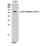 Western Blot - Anti-p70 S6 Kinase (phospho Ser371) Antibody (A0532) - Antibodies.com