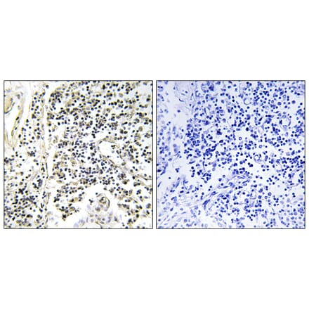 Immunohistochemistry - Anti-IkappaB-alpha (phospho Tyr305) Antibody (A1053) - Antibodies.com