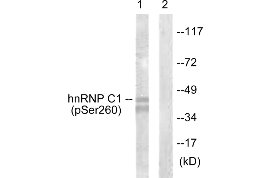 Western Blot - Anti-hnRNP C1 + C2 (phospho Ser260) Antibody (A1041) - Antibodies.com