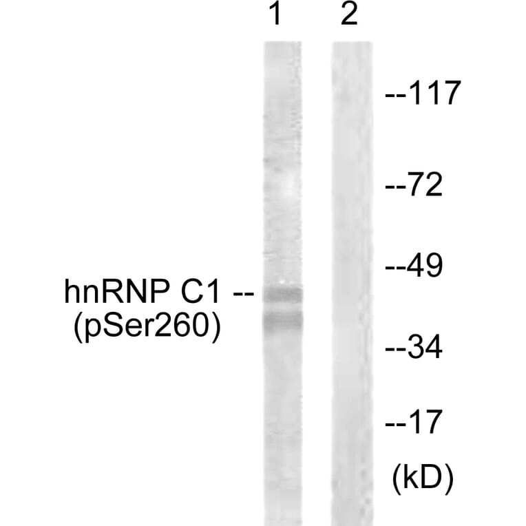 Western Blot - Anti-hnRNP C1 + C2 (phospho Ser260) Antibody (A1041) - Antibodies.com