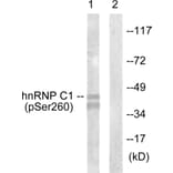 Western Blot - Anti-hnRNP C1 + C2 (phospho Ser260) Antibody (A1041) - Antibodies.com