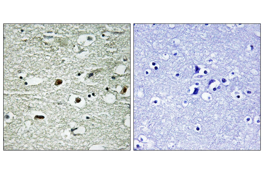 Immunohistochemistry - Anti-hnRNP C1 + C2 (phospho Ser260) Antibody (A1041) - Antibodies.com