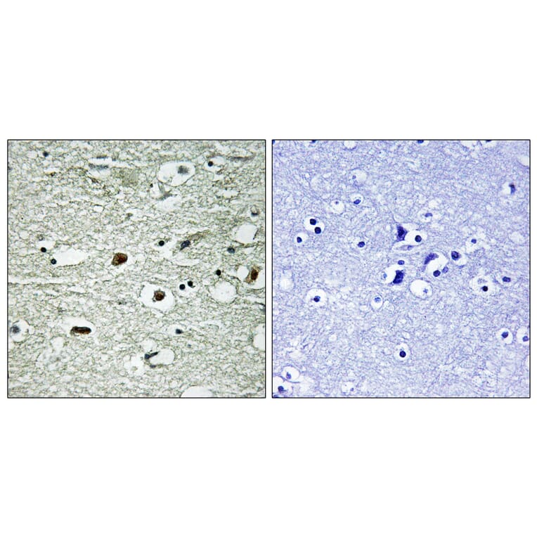 Immunohistochemistry - Anti-hnRNP C1 + C2 (phospho Ser260) Antibody (A1041) - Antibodies.com