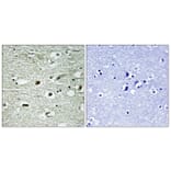 Immunohistochemistry - Anti-hnRNP C1 + C2 (phospho Ser260) Antibody (A1041) - Antibodies.com