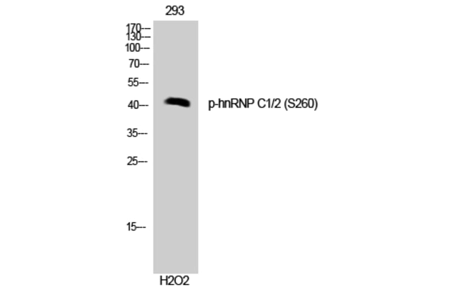 Western Blot - Anti-hnRNP C1 + C2 (phospho Ser260) Antibody (A1041) - Antibodies.com
