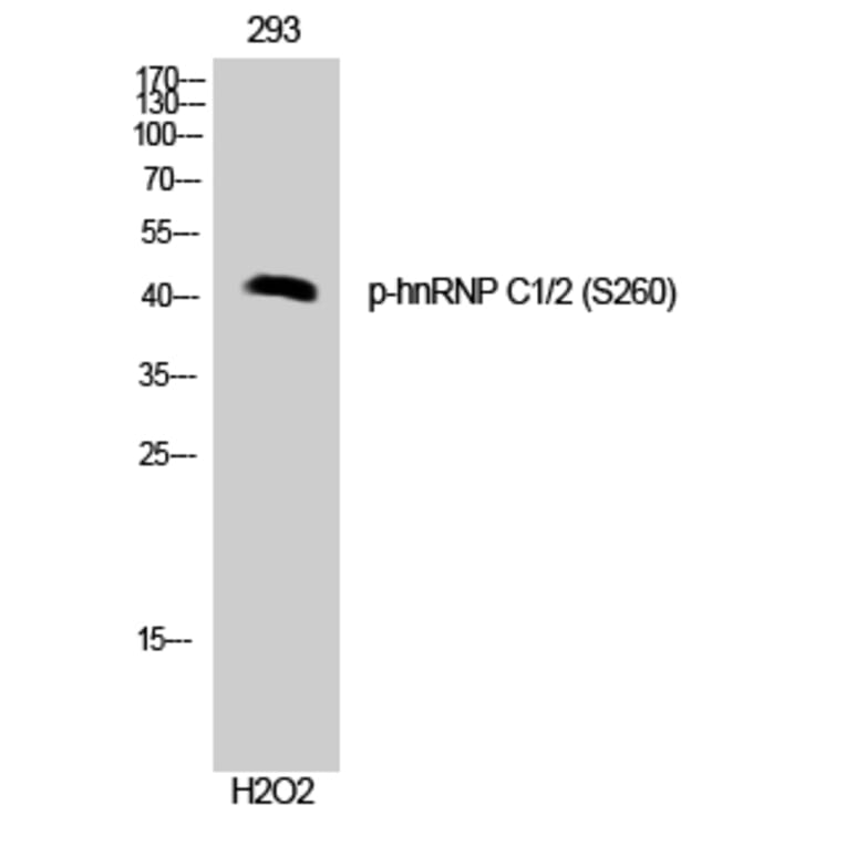 Western Blot - Anti-hnRNP C1 + C2 (phospho Ser260) Antibody (A1041) - Antibodies.com
