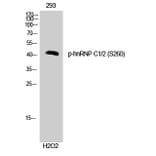 Western Blot - Anti-hnRNP C1 + C2 (phospho Ser260) Antibody (A1041) - Antibodies.com