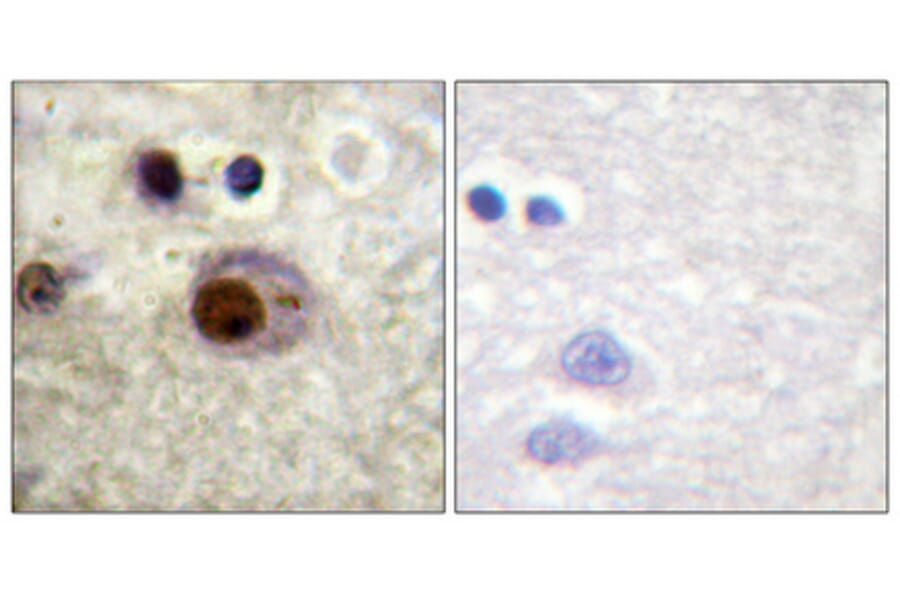 Immunohistochemistry - Anti-hnRNP C1 + C2 (phospho Ser260) Antibody (A1041) - Antibodies.com