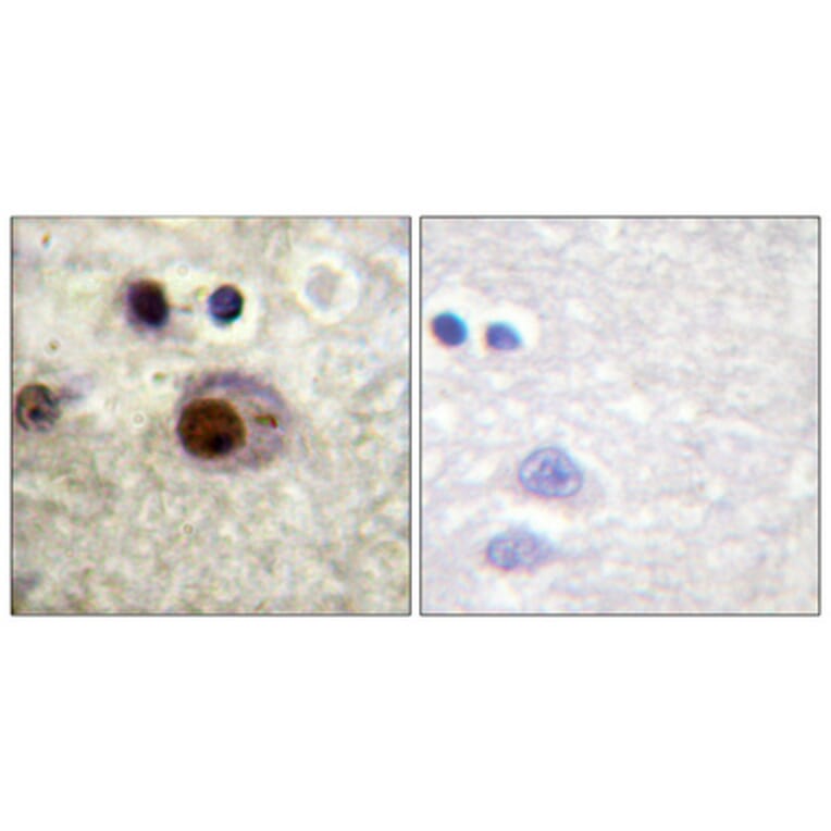 Immunohistochemistry - Anti-hnRNP C1 + C2 (phospho Ser260) Antibody (A1041) - Antibodies.com
