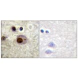 Immunohistochemistry - Anti-hnRNP C1 + C2 (phospho Ser260) Antibody (A1041) - Antibodies.com
