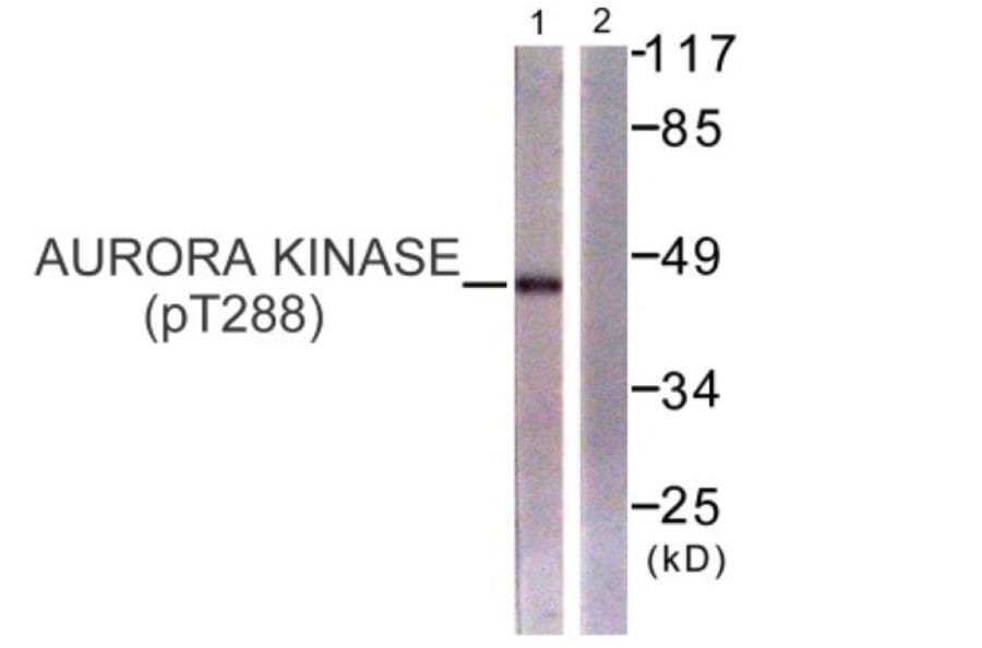 Western Blot - Anti-Aurora Kinase (phospho Thr288) Antibody (A0459) - Antibodies.com