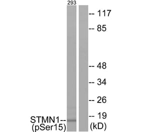 Western Blot - Anti-Stathmin 1 (phospho Ser15) Antibody (A7230) - Antibodies.com