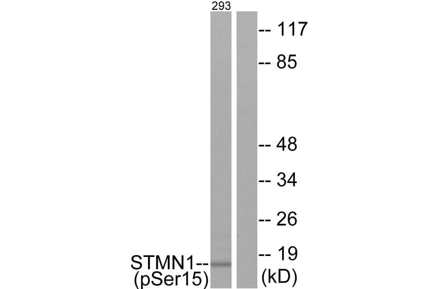Western Blot - Anti-Stathmin 1 (phospho Ser15) Antibody (A7230) - Antibodies.com