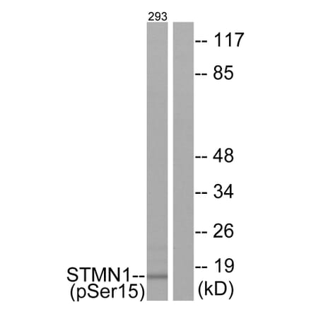 Western Blot - Anti-Stathmin 1 (phospho Ser15) Antibody (A7230) - Antibodies.com