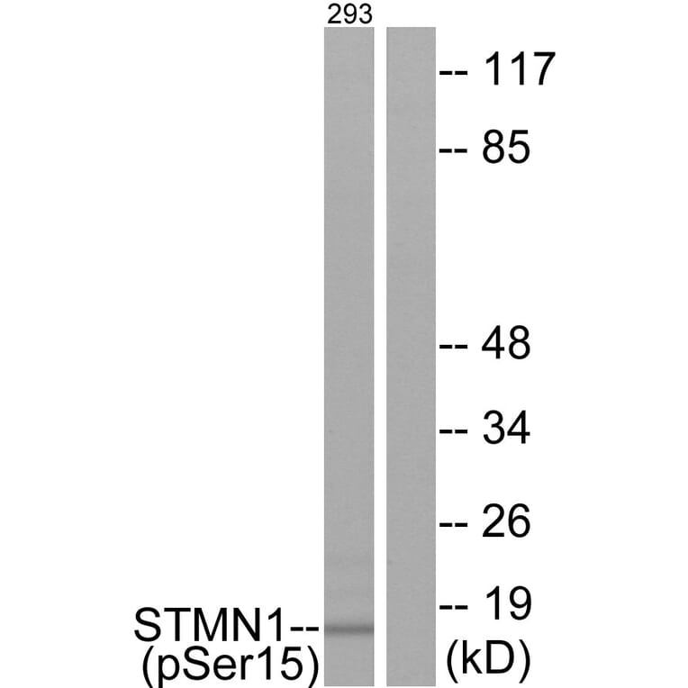 Western Blot - Anti-Stathmin 1 (phospho Ser15) Antibody (A7230) - Antibodies.com