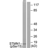 Western Blot - Anti-Stathmin 1 (phospho Ser15) Antibody (A7230) - Antibodies.com