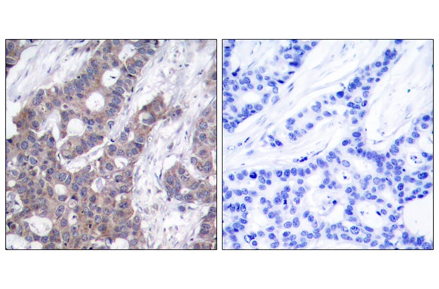 Immunohistochemistry - Anti-Stathmin 1 (phospho Ser15) Antibody (A7230) - Antibodies.com