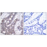 Immunohistochemistry - Anti-Stathmin 1 (phospho Ser15) Antibody (A7230) - Antibodies.com