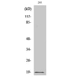 Western Blot - Anti-Stathmin 1 (phospho Ser15) Antibody (A7230) - Antibodies.com