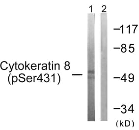 Western Blot - Anti-Keratin 8 (phospho Ser432) Antibody (A0883) - Antibodies.com