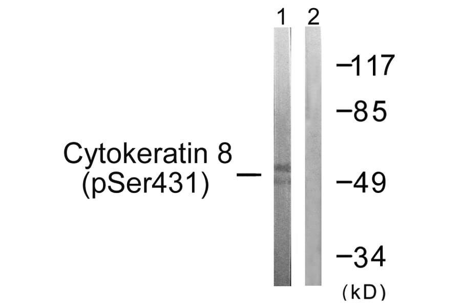 Western Blot - Anti-Keratin 8 (phospho Ser432) Antibody (A0883) - Antibodies.com