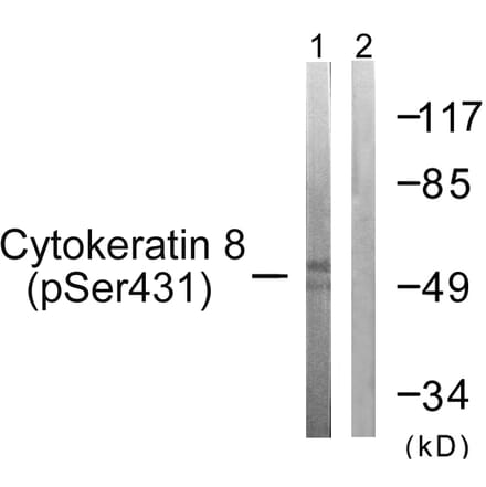 Western Blot - Anti-Keratin 8 (phospho Ser432) Antibody (A0883) - Antibodies.com