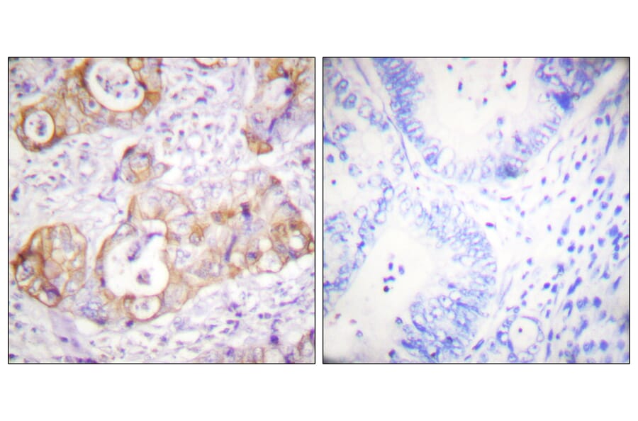 Immunohistochemistry - Anti-Keratin 8 (phospho Ser432) Antibody (A0883) - Antibodies.com