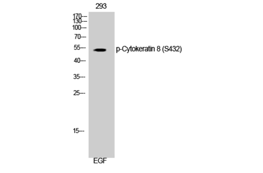 Western Blot - Anti-Keratin 8 (phospho Ser432) Antibody (A0883) - Antibodies.com