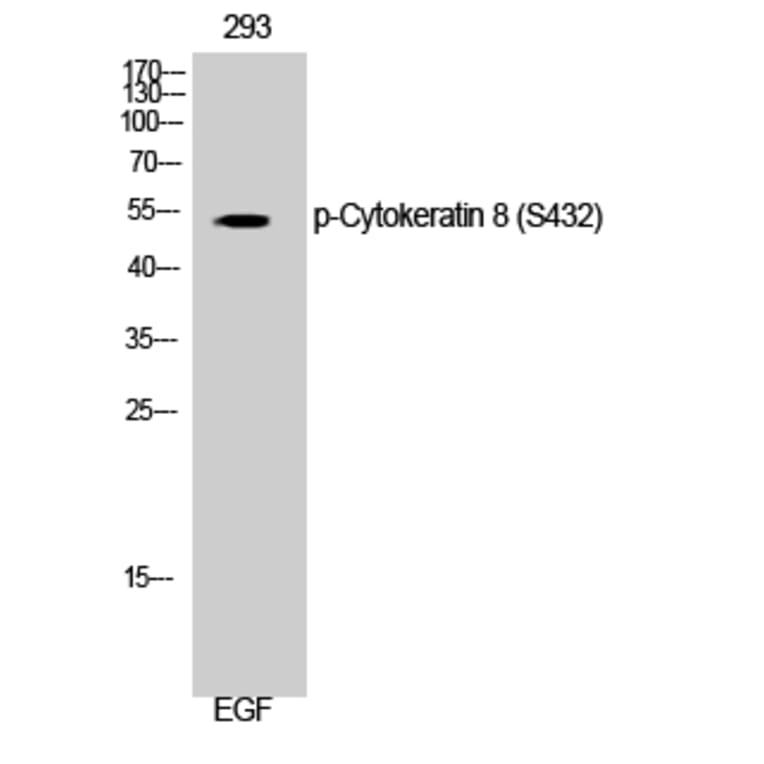 Western Blot - Anti-Keratin 8 (phospho Ser432) Antibody (A0883) - Antibodies.com