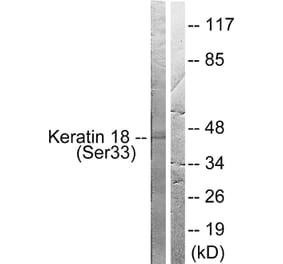 Western Blot - Anti-Keratin 18 (phospho Ser33) Antibody (A0016) - Antibodies.com