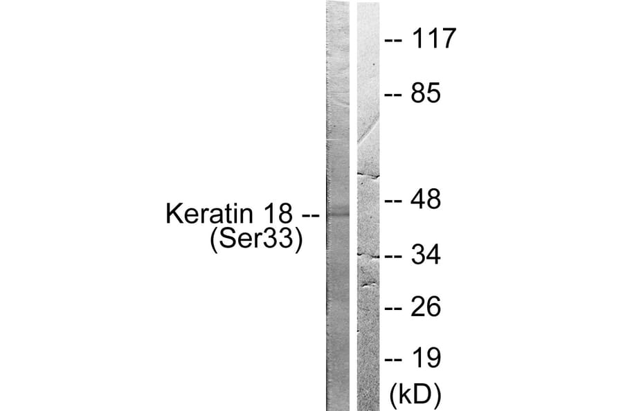 Western Blot - Anti-Keratin 18 (phospho Ser33) Antibody (A0016) - Antibodies.com