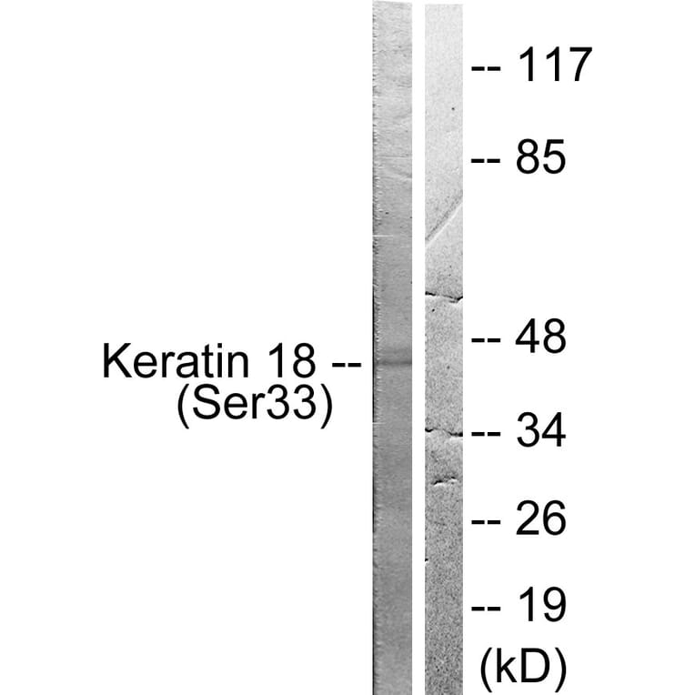 Western Blot - Anti-Keratin 18 (phospho Ser33) Antibody (A0016) - Antibodies.com